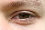 Makrokuva ihmisen silmästä. Silmä on väritykseltään ruskea ja se on melkein sirrissä. Silmän yläpuolelal haaleita kulmakarvoja vaaleaa ihoa vasten.